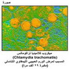   (Chlamydia trachomatis)      